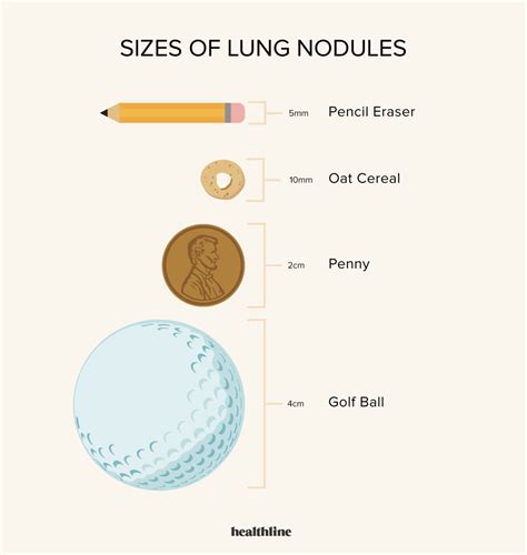 The differential diagnosis of a nodule or mass detected on a radiograph or CT is very broad (Table 4. . Lung nodule size chart